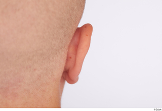 Jerome ear 0004.jpg